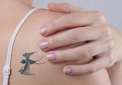 Laat uw tattoo weglaseren door de specialist van Nederland!