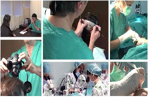 Goedkope haartransplantatie van de beste klinieken?