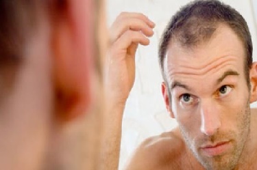 Haaruitval bestrijden met een voordelige haartransplantatie?