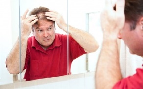 Haaruitval bestrijden met een voordelige haartransplantatie?