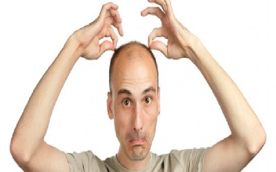 Goedkope haartransplantatie van de beste klinieken?