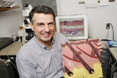 Haarimplantatie aanbieding van de beste klinieken