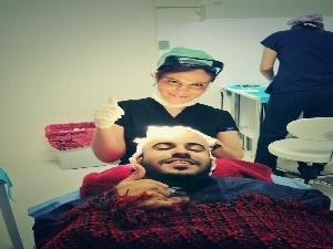 Haarimplantatie aanbieding van de beste klinieken