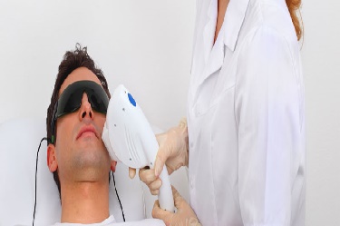 Haartransplantatie aanbieding.