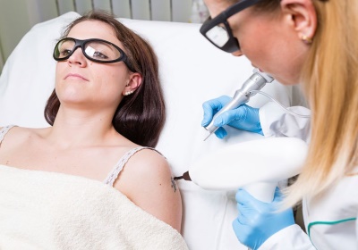 Laat uw tattoo laseren door een echte specialist!