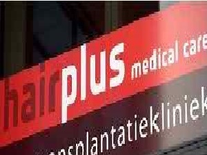 Haartransplantatie aanbieding